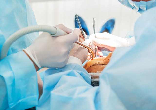 口腔外科専門医